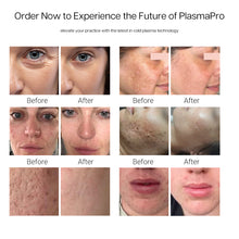 Load image into Gallery viewer, cold_plasma_machine effect