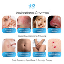 Carica l'immagine nel visualizzatore di Gallery, Portable Co2 Fractional Laser Resurfacing Machine for Skin Repair and Whitening