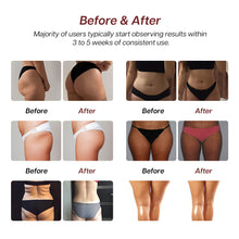 Charger l'image dans la galerie, renasculpt before and after