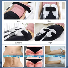 Load image into Gallery viewer, Renasculpt® FE60 Max 5 Handles EMS RF Sculpting Machine Neo