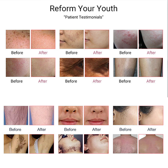 Before & After