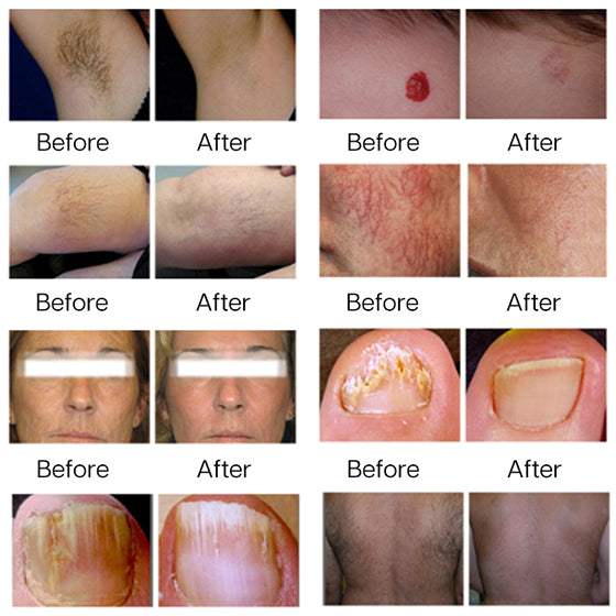 Before & After