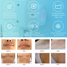 Load image into Gallery viewer, Winkonlaser Non Crystal Epilator Diode Laser 755 808 1064 AresLite Painless Laser Hair Removal Machine

