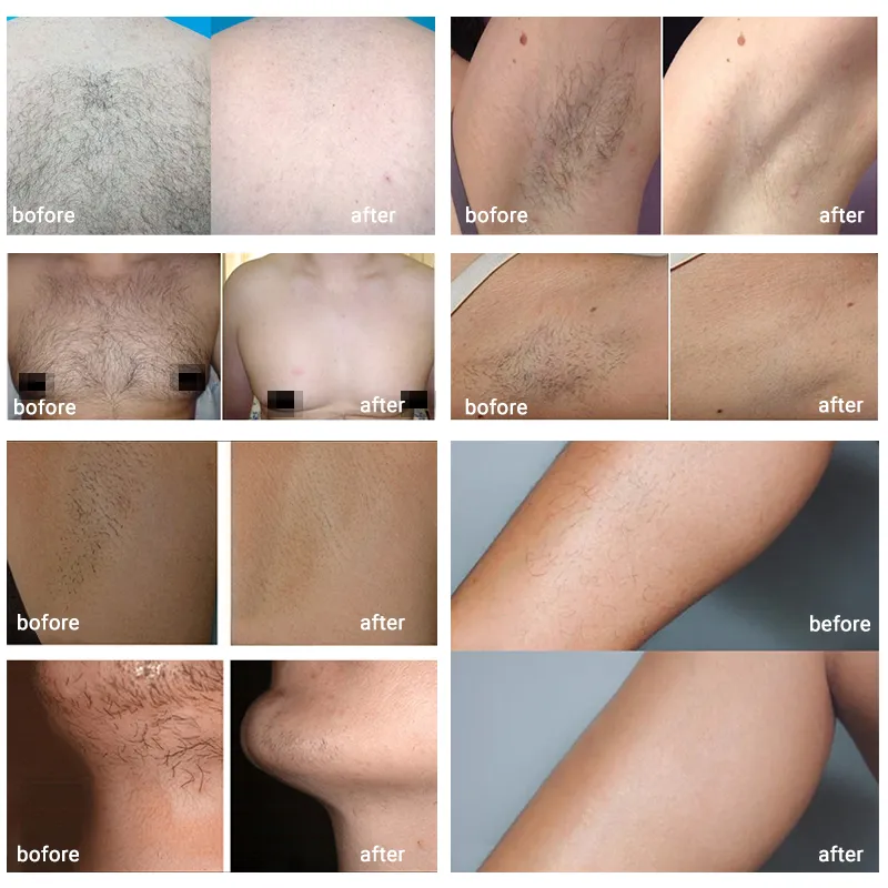 Before & After