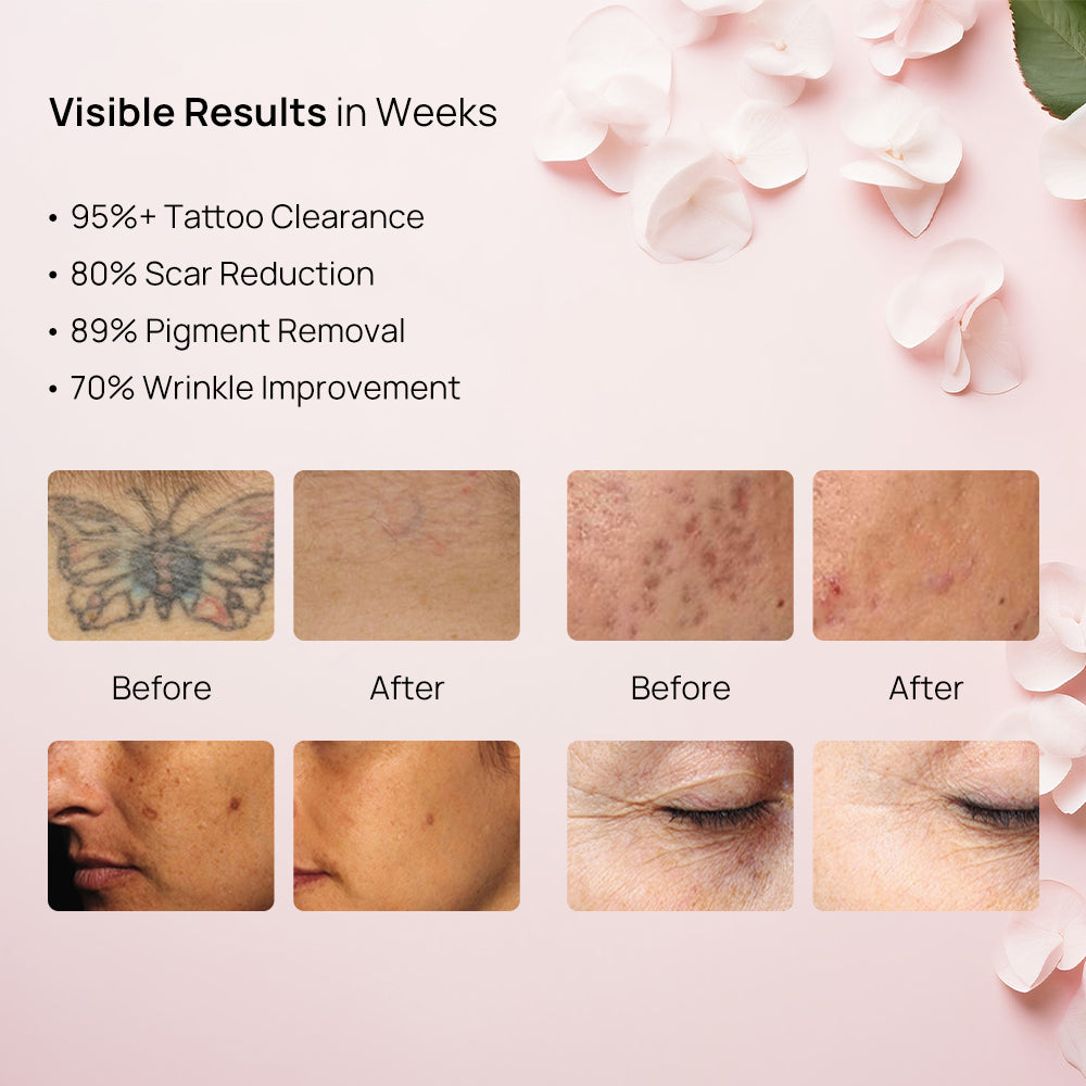 Before & After