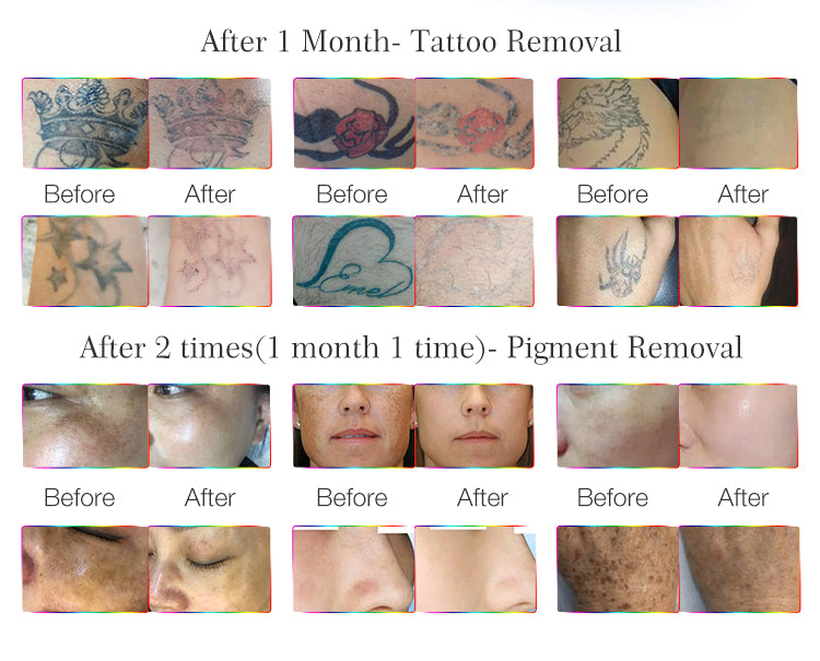 Before & After