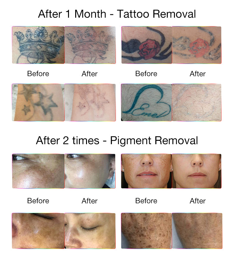 Before & After