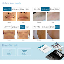 Load image into Gallery viewer, Winkonlaser Non Crystal 3 Wavelength Painless Diode Laser Hair Removal Machine
